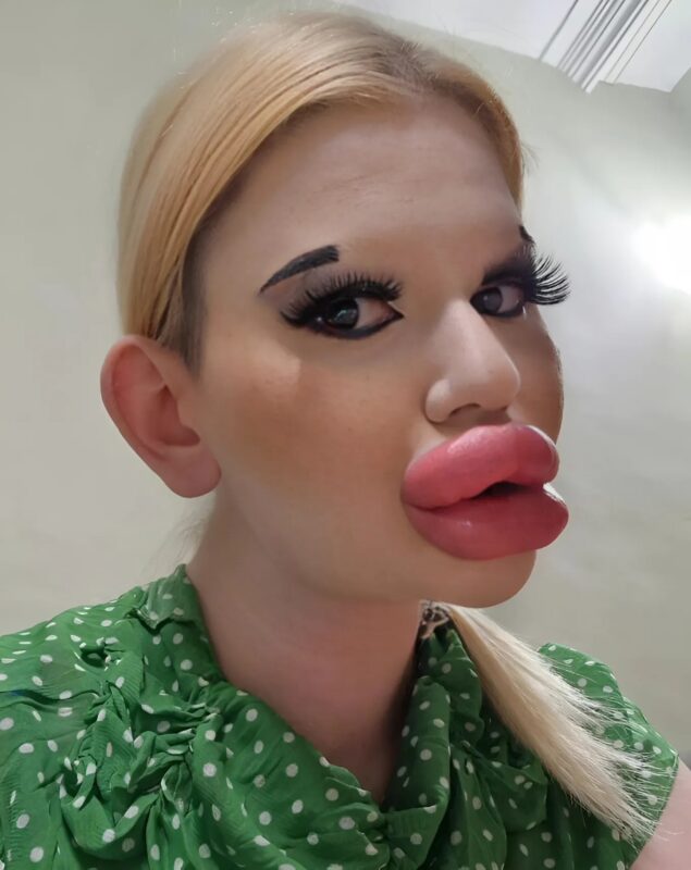 plastikkirurgi