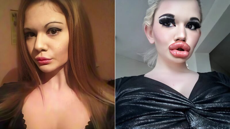 plastikkirurgi