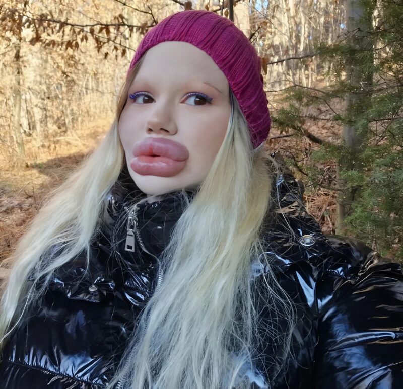 plastikkirurgi